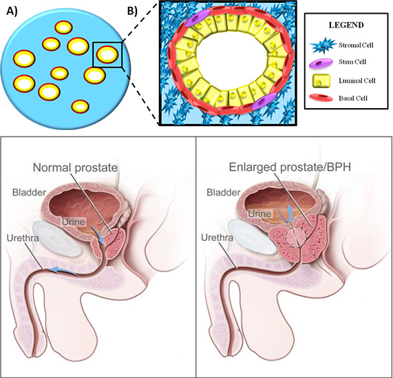 prostate graphic